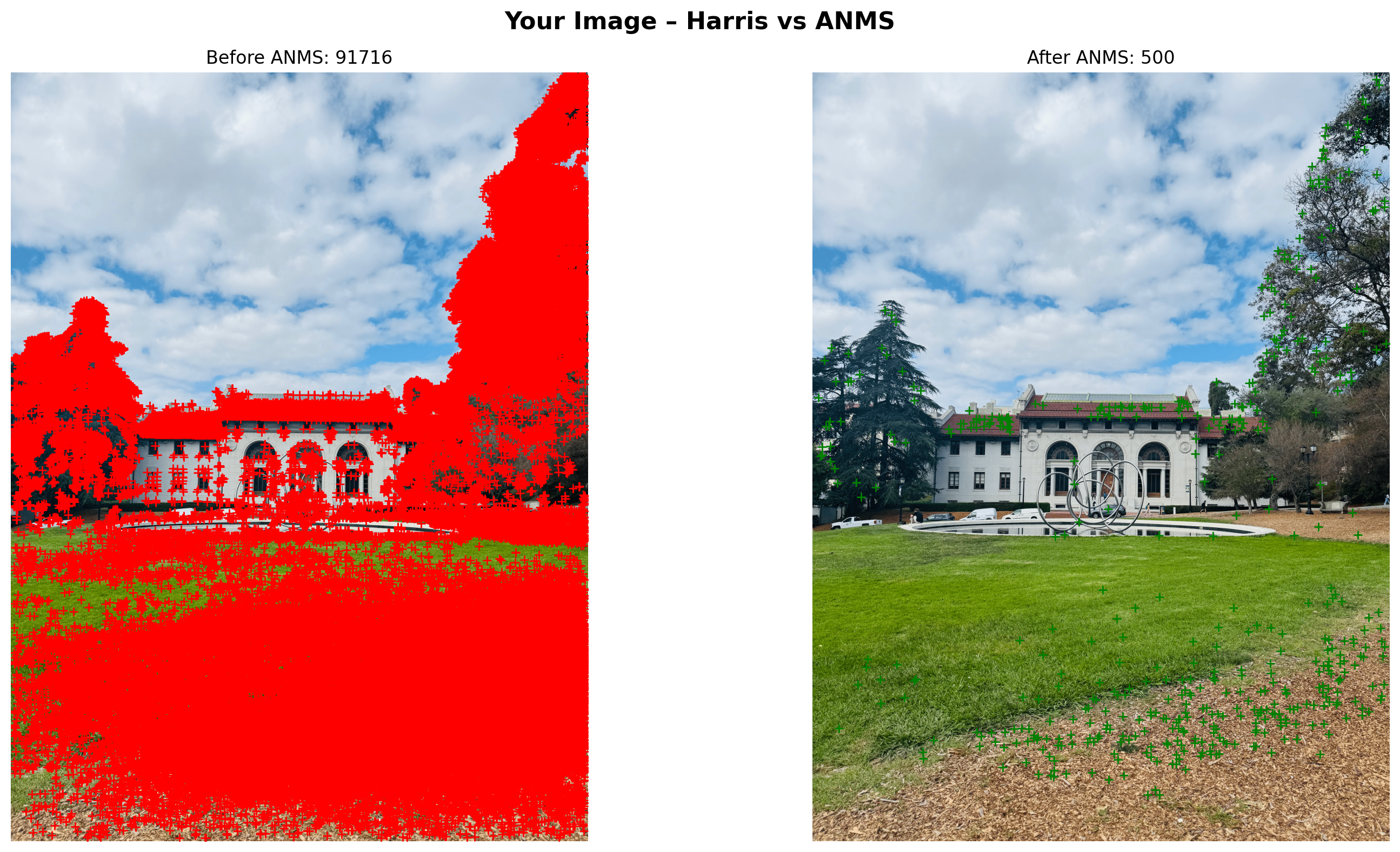 Harris vs ANMS on Hearst Left